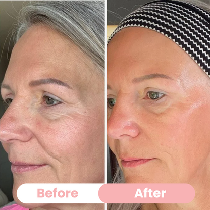 Aura Bio-Collagen Masks