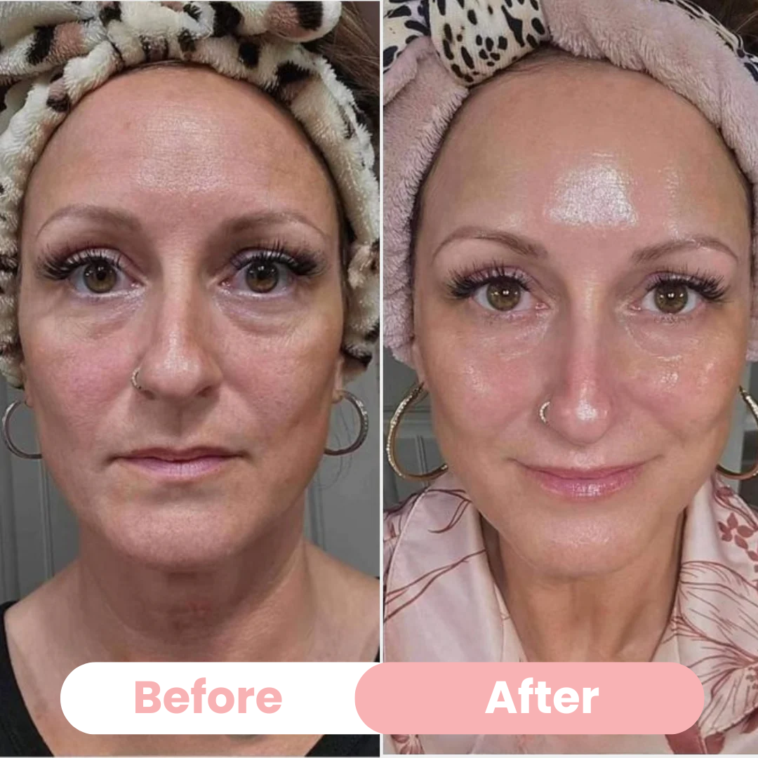 Aura Bio-Collagen Masks