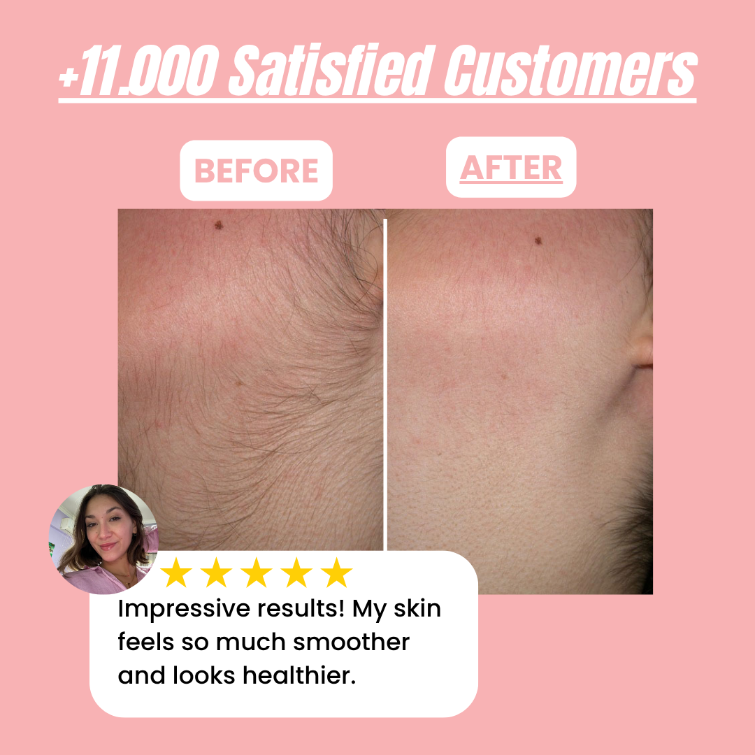 Aura Instant Hair Removal Kit