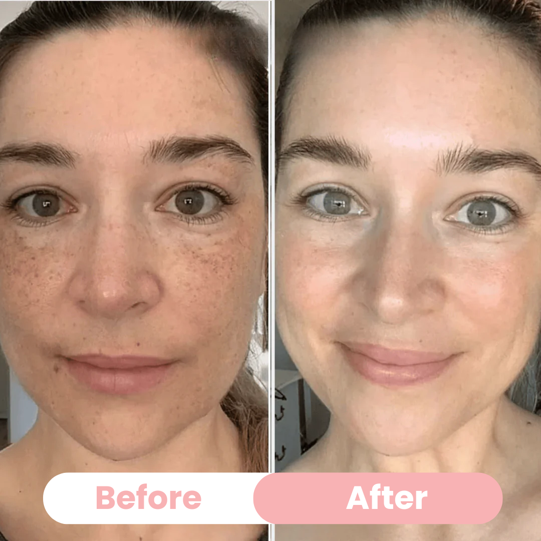 Aura Bio-Collagen Masks